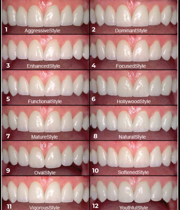 Design your smile
